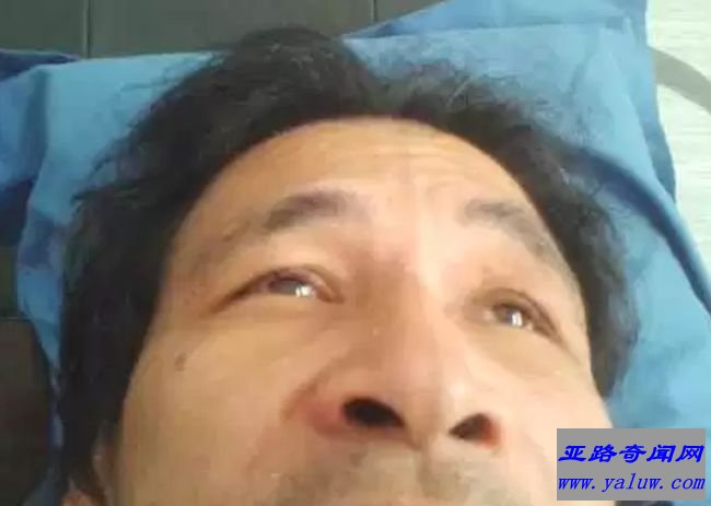 致死性失眠