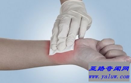 抗出血凝胶