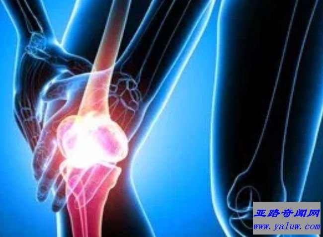 控制关节炎疼痛